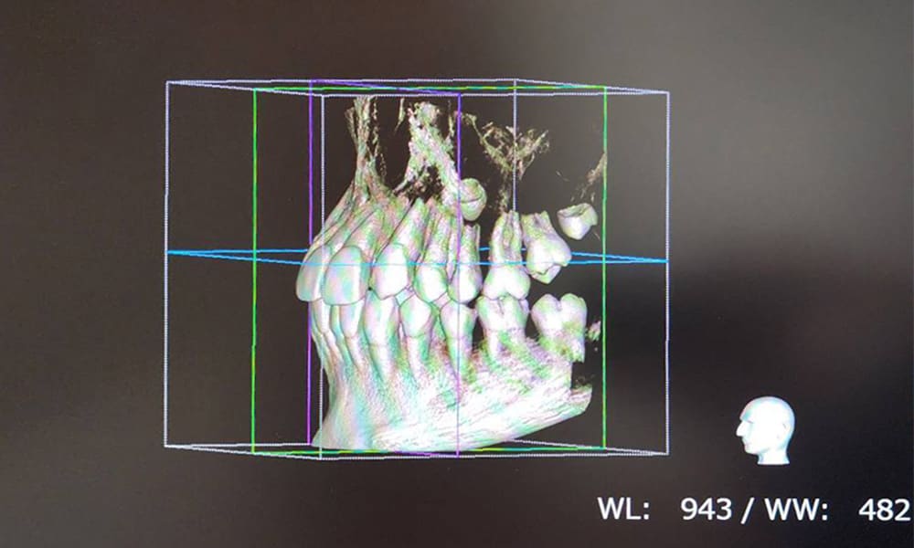 3Dデジタル矯正 / 矯正治療について - 江口矯正歯科クリニック